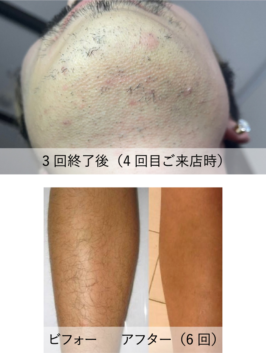 理由その3-効果には性別・年齢を問いません-